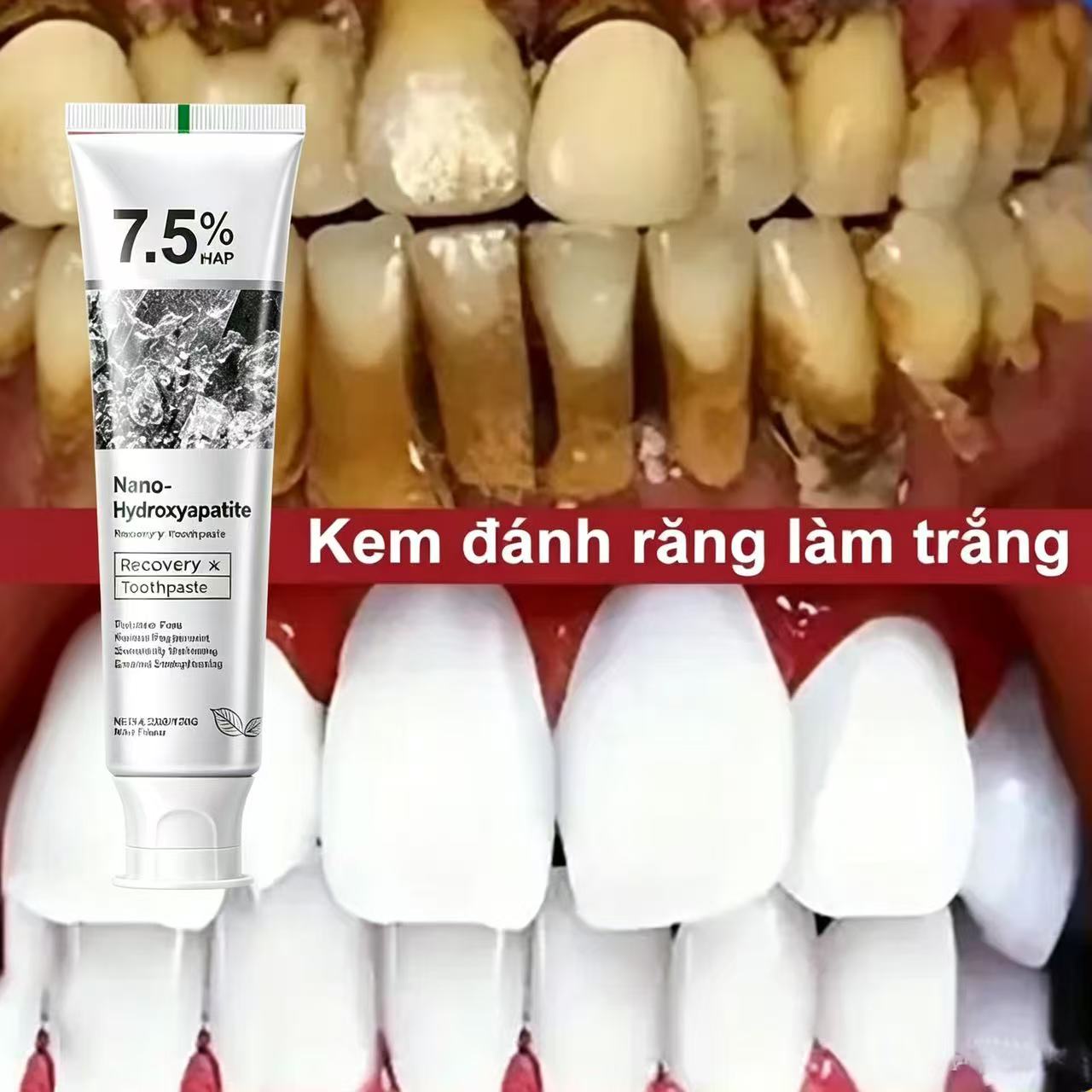 Teeth Whitening Cream - 7.5% ไฮดรอกซีอะพาไทต์ โปรไบโอติก ไวท์เทนนิ่ง ยาสีฟัน เอนาเมล