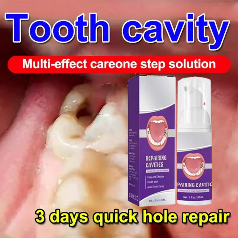 Teeth Whitening Cream - ทําความสะอาดฟันยาสีฟันขจัดคราบฟันฟันไวท์เทนนิ่งฟันผุซ่อมแคลคูลัสแผ่นโรคปริทันต์อักเสบลบฟันผุ