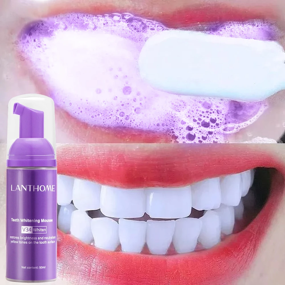 Teeth Whitening Crest - มูส V34ยาสีฟันมีประสิทธิภาพทำความสะอาดฟันยาสีฟันสูตรฟันขาวฟันเหลืองลบคราบฟันผลิตภัณฑ์ทำความสะอาดปาก50มล