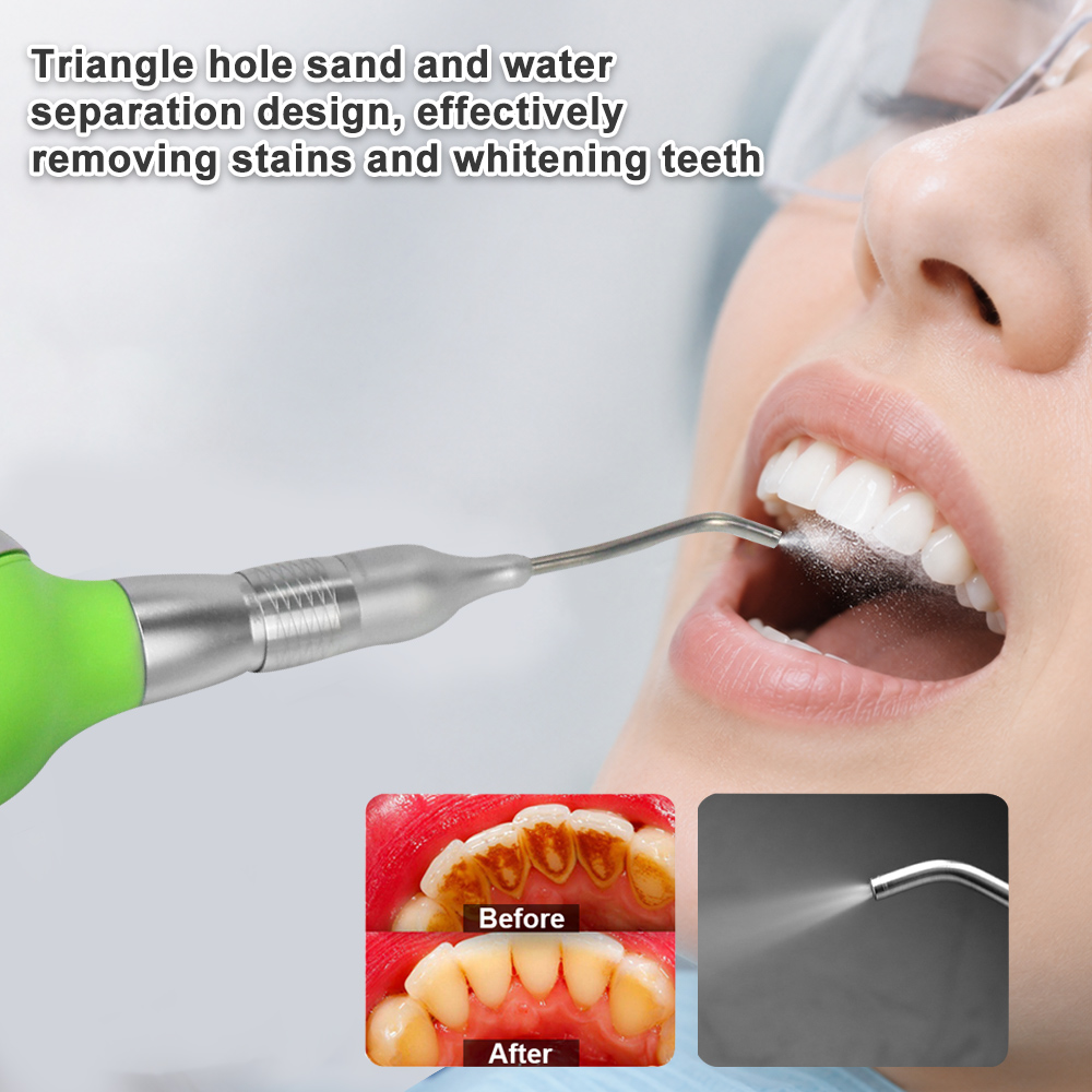 เครื่องขัดฟันด้วยลมพร้อมอุปกรณ - Teeth Whitening Options บทวิจารณ์และราคา