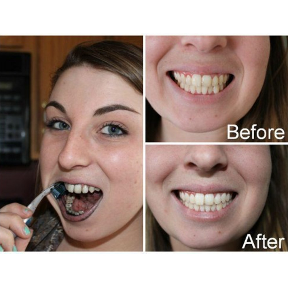 ถ่านไม้ไผ่ฟันฟันทันตกรรมสูตร L - Teeth Whitening Ingredients บทวิจารณ์และราคา