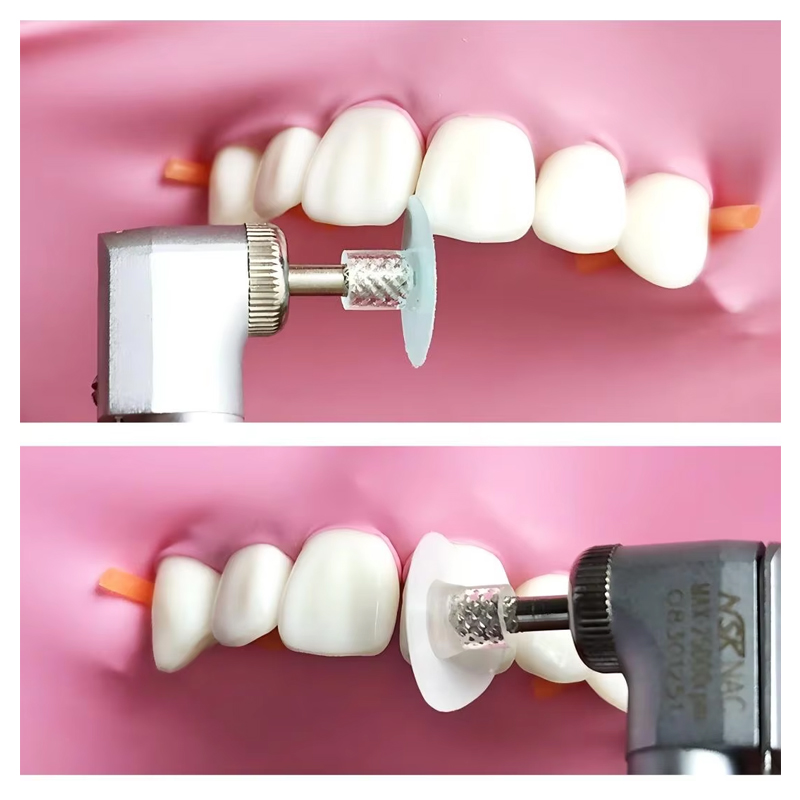 แผ่นขัดฟัน 40 ชิ้น สำหรับขัดเร - Whitening Teeth Dentist บทวิจารณ์และราคา