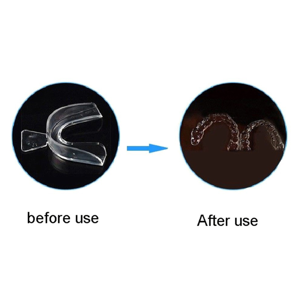 ชุดอุปกรณ์จัดฟันแบบนุ่ม 2/4 ชิ - Teeth Whitening For Trays บทวิจารณ์และราคา