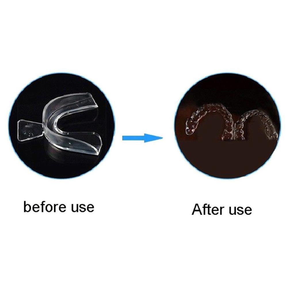 ที่ครอบฟันซิลิโคนสำหรับจัดฟัน  - Teeth Whitening For Trays บทวิจารณ์และราคา