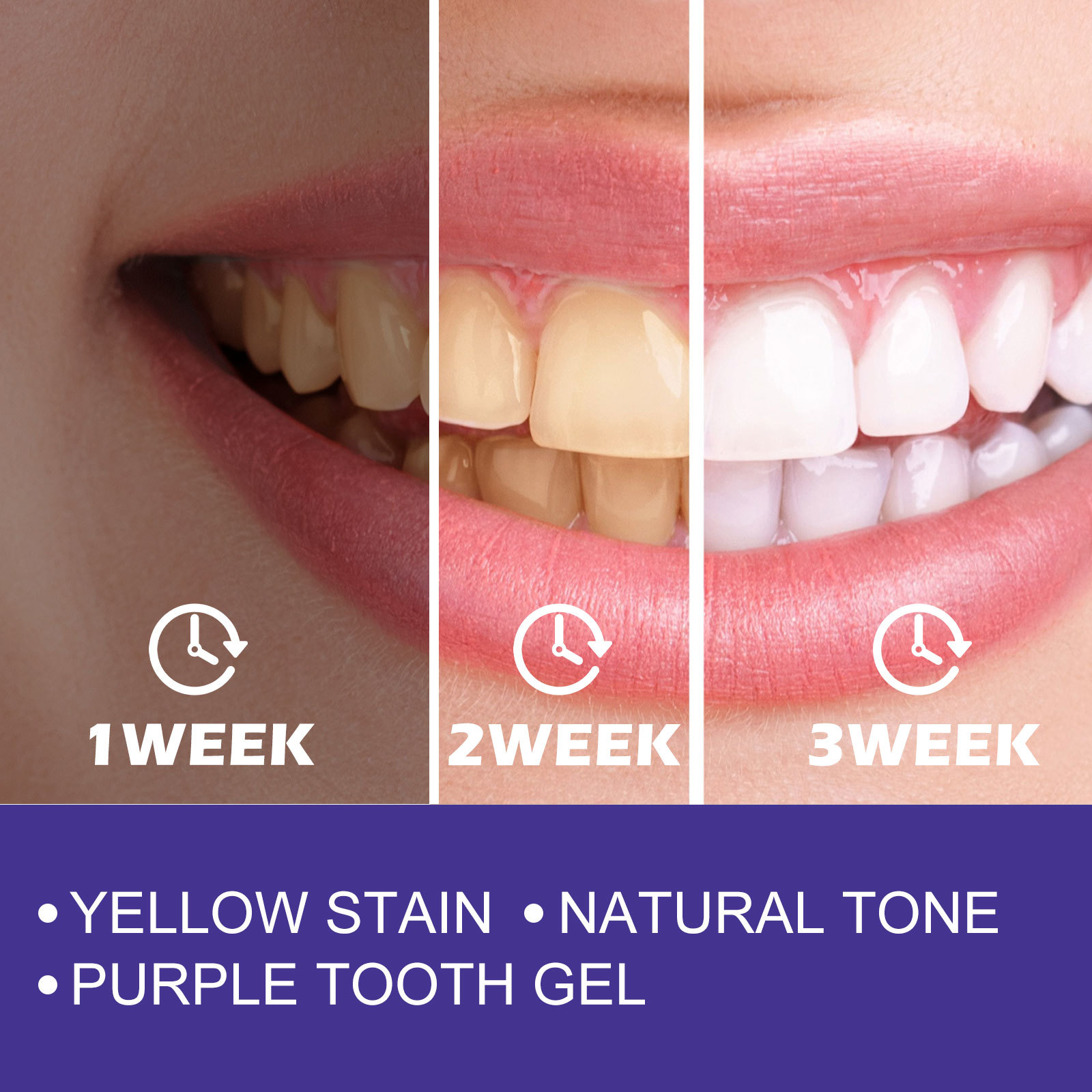 ยาสีฟันสีม่วง ฟอกฟันขาว ขจัดคร - Teeth Whitening Crest บทวิจารณ์และราคา
