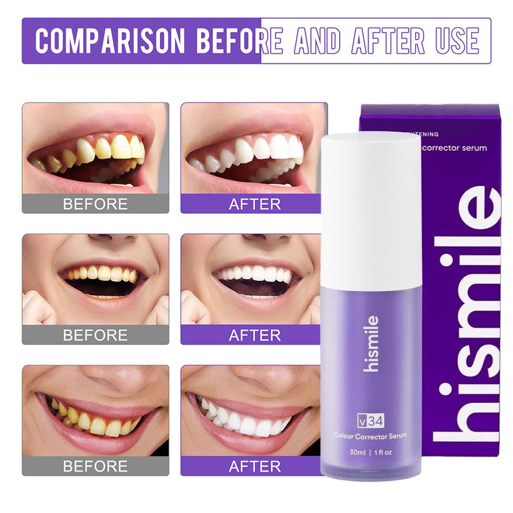    เซรั่มฟอกฟันขาว Hismile สี - Teeth Whitening Crest บทวิจารณ์และราคา