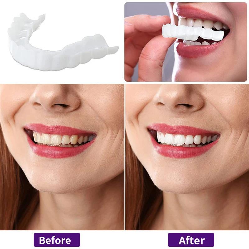วีเนียร์ฟันธรรมชาติแบบใหม่ ปรั - Teeth Whitening Options บทวิจารณ์และราคา