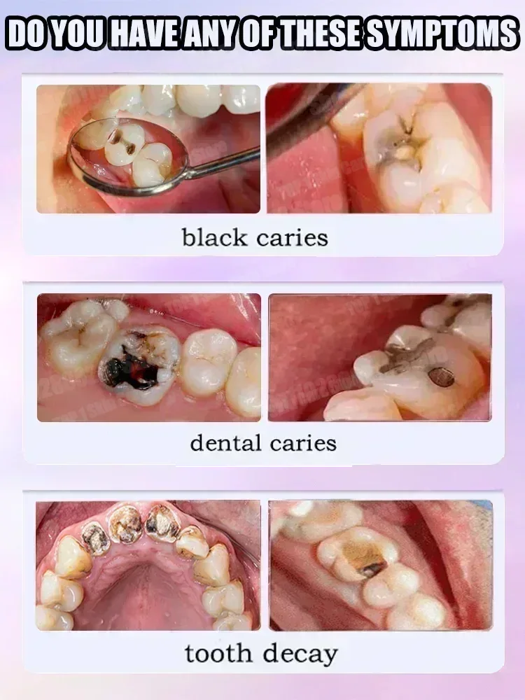 ขายดีที่สุด ซ่อมแซมฟันผุทางวิท - Teeth Whitening Toothpaste บทวิจารณ์และราคา