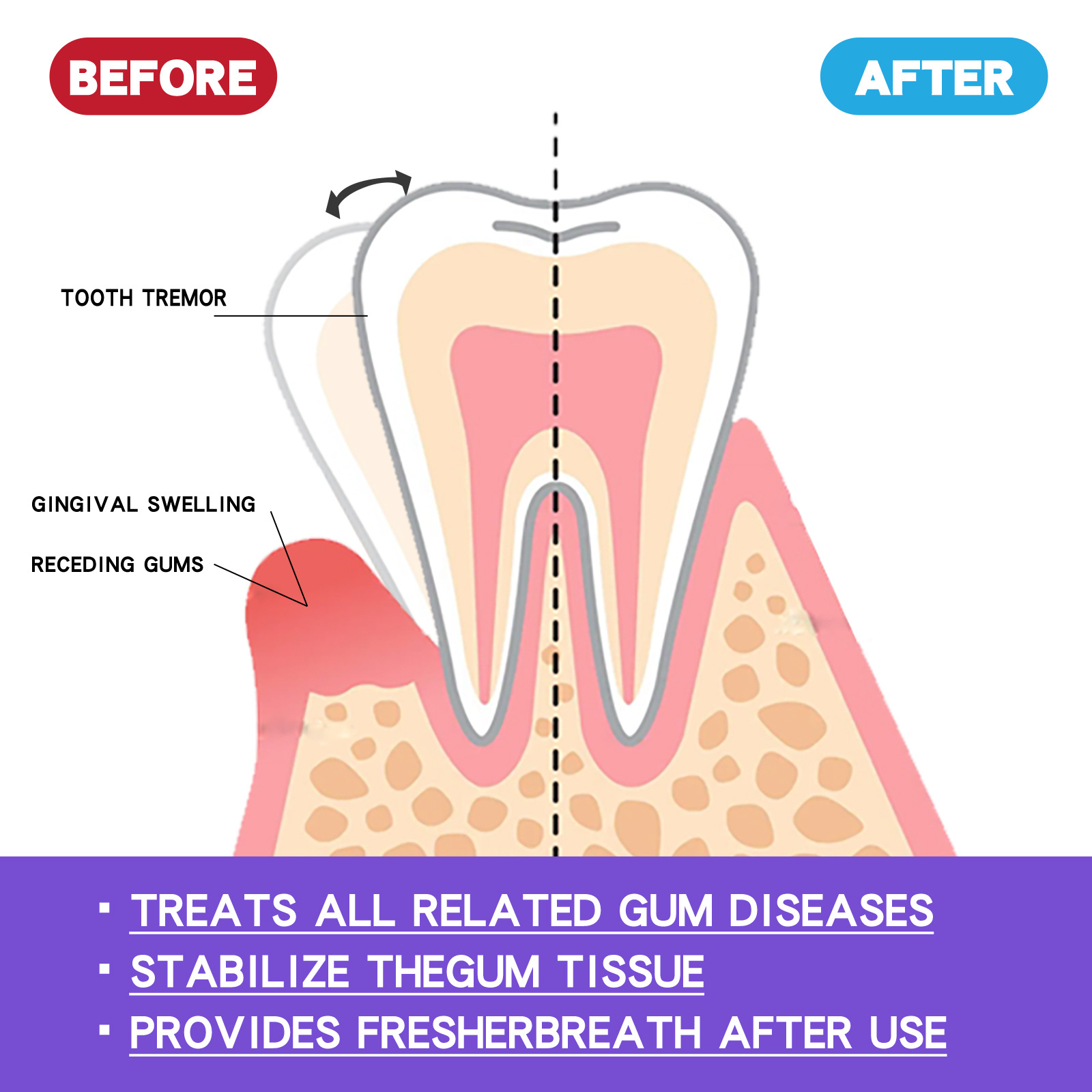 60ml ฟันไวท์เทนนิ่งมูส V34 ทํา - Teeth Whitening Crest บทวิจารณ์และราคา