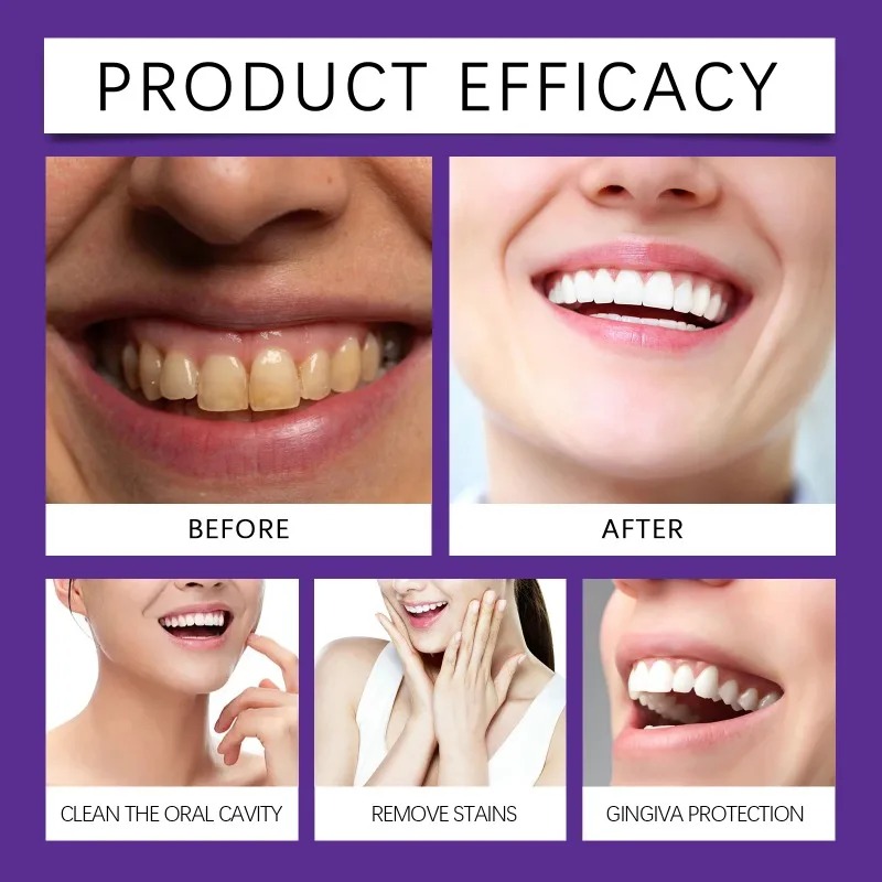 ผงแร่ฟื้นฟูฟันสีม่วง ผงยาสีฟัน - Teeth Whitening Ingredients บทวิจารณ์และราคา