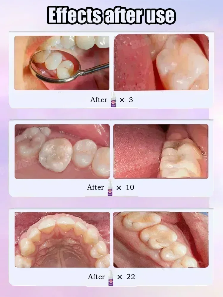 ทําความสะอาดฟันยาสีฟันขจัดคราบ - Teeth Whitening Cream บทวิจารณ์และราคา