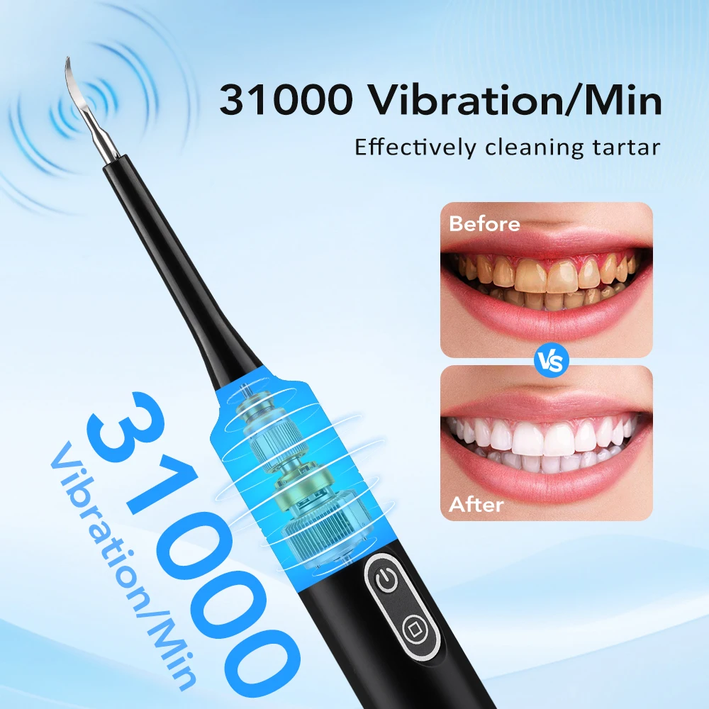 เครื่องขจัดคราบหินปูนไฟฟ้าแบบส - Whitening Teeth Dentist บทวิจารณ์และราคา